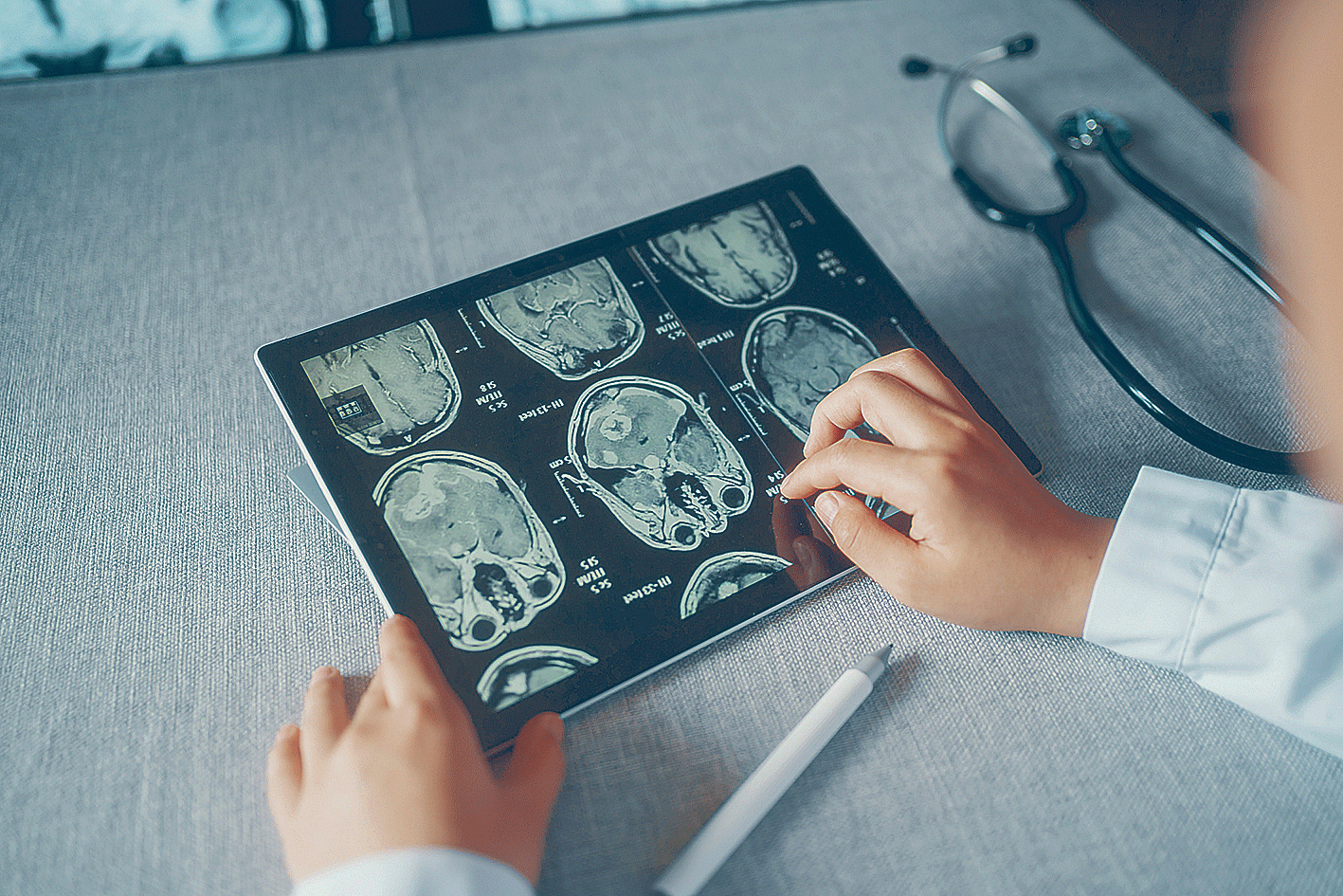 Darstellung von einem Ct-Scan eines Gehirns.